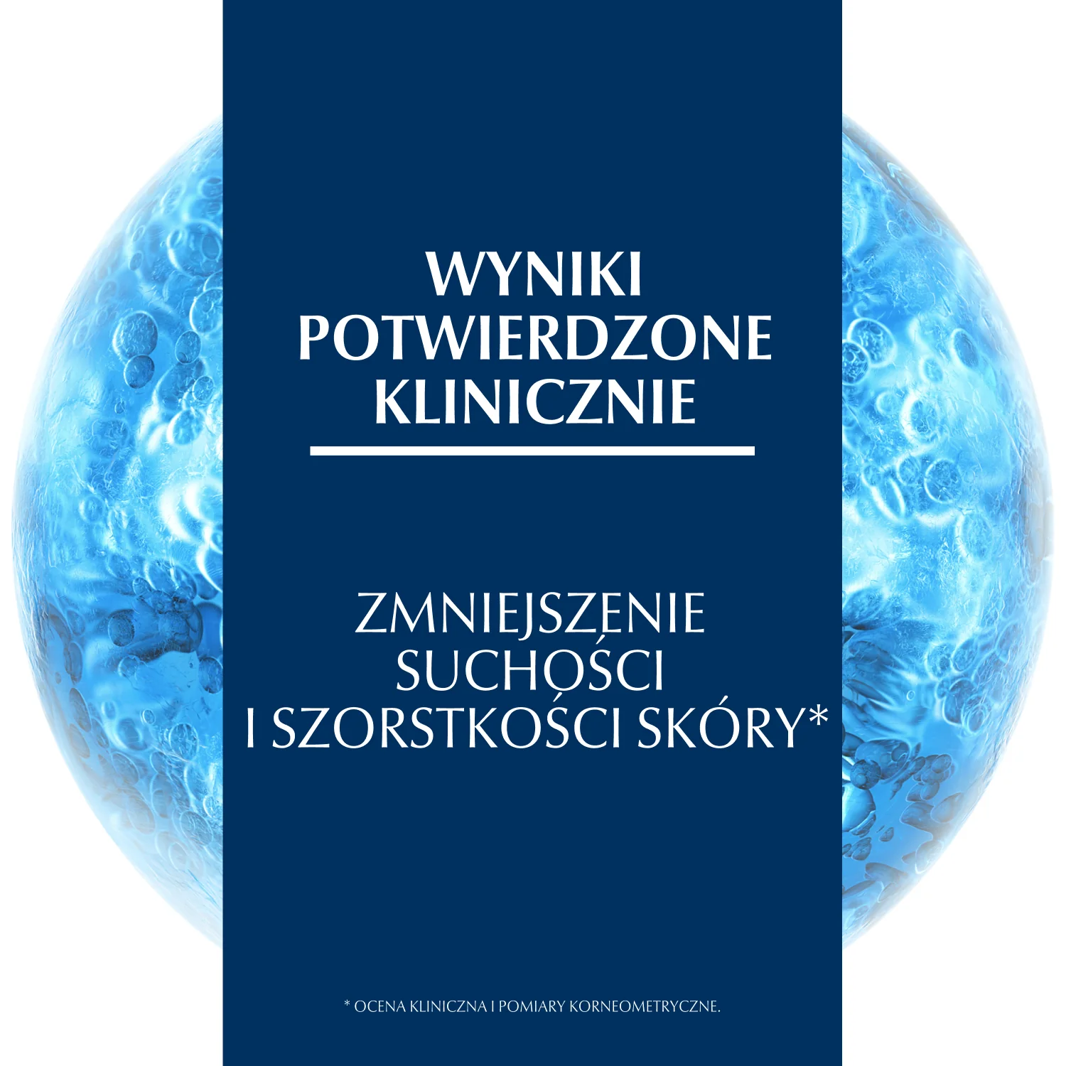 Eucerin UreaRepair PLUS regenerujący krem do rąk z 5% mocznika, 75 ml