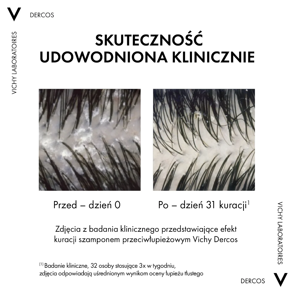 Vichy Dercos szampon przeciwłupieżowy do włosów suchych, 200 ml