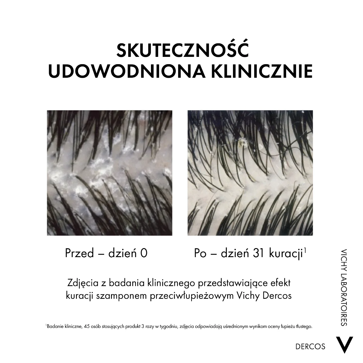 VICHY DERCOS Szampon Przeciwłupieżowy z odżywką 2w1, 390ml