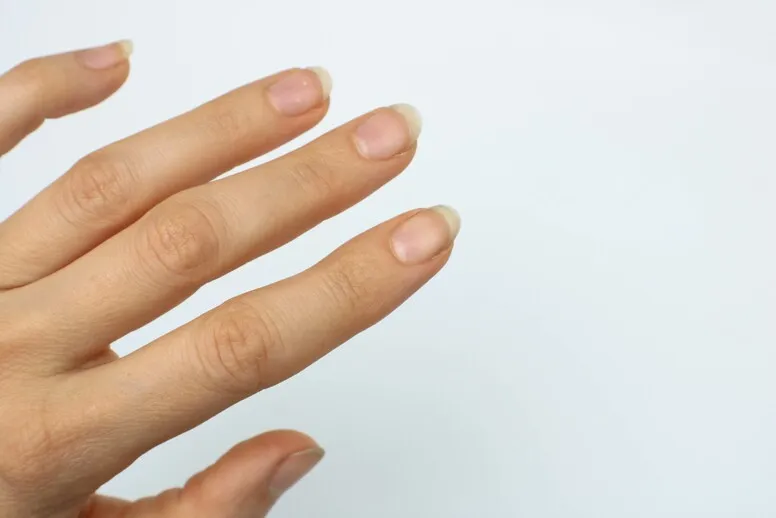 Jak leczyć rozdwajające się paznokcie? 