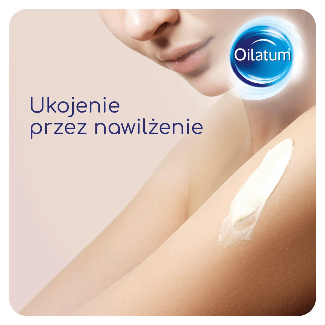 Oilatum Formuła MED krem do skóry bardzo suchej, 150 ml 